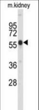 Western blot of Park6 (PINK1) C-term in mouse kidney tissue lysates (35 ug/lane). Park6 (arrow) was detected using the purified antibody.