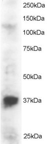 Antibody staining (2 ug/ml) of Jurkat lysate (RIPA buffer, 30 ug total protein per lane). Primary incubated for 1 hour. Detected by Western blot of chemiluminescence.