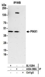 Detection of Human PINX1 by Western Blot of Immunoprecipitates. Samples: Whole cell lysate (0.5 or 1.0 mg per IP reaction; 20% of IP loaded) prepared using NETN buffer from Jurkat cells. Antibodies: Affinity purified rabbit anti-PINX1 antibody used for IP at 6 ug per reaction. PINX1 was also immunoprecipitated by rabbit anti-PINX1 antibody BL15294. For blotting immunoprecipitated PINX1, was used at 1 ug/ml. Detection: Chemiluminescence with an exposure time of 3 minutes.