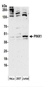 Detection of Human PINX1 by Western Blot. Samples: Whole cell lysate (50 ug) prepared using NETN buffer from HeLa, 293T, and Jurkat cells. Antibodies: Affinity purified rabbit anti-PINX1 antibody used for WB at 0.4 ug/ml. Detection: Chemiluminescence with an exposure time of 3 minutes.