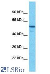PIP4K2B antibody Western Blot of NCI-H226. Antibody dilution: 1 ug/ml.