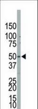 The anti-PIP5K2B antibody is used in Western blot to detect PIP5K2B in NCI-H460 cell lysate.