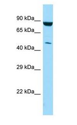 PIP4K2C antibody Western Blot of MCF7.