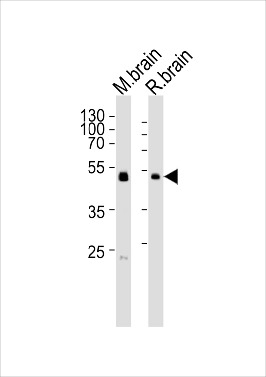 Western blot of lysates from mouse brain and rat brain tissue lysate (from left to right) with PIP4K2C Antibody. Antibody was diluted at 1:1000 at each lane. A goat anti-rabbit IgG H&L (HRP) at 1:5000 dilution was used as the secondary antibody. Lysates at 35 ug per lane.
