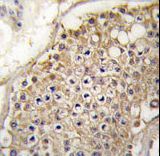 Formalin-fixed and paraffin-embedded human testis tissue reacted with PIP5K2G Antibody , which was peroxidase-conjugated to the secondary antibody, followed by DAB staining. This data demonstrates the use of this antibody for immunohistochemistry; clinical relevance has not been evaluated.