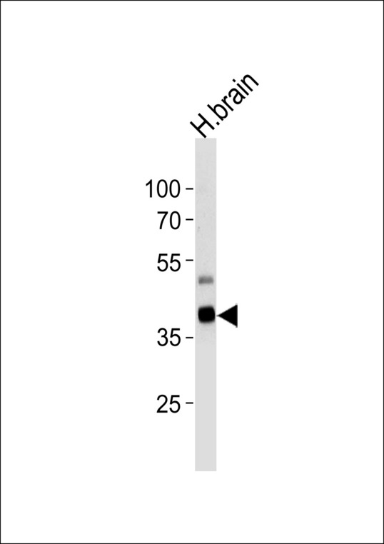 Western blot of lysate from human brain tissue lysate, using PIP5K2G Antibody(E348). Antibody was diluted at 1:1000 at each lane. A goat anti-rabbit IgG H&L (HRP) at 1:5000 dilution was used as the secondary antibody. Lysate at 35ug per lane.