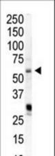 Western blot of anti-PIP5K1A antibody in HeLa cell lysate. PIP5K1A (arrow) was detected using purified antibody. Secondary HRP-anti-rabbit was used for signal visualization with chemiluminescence.