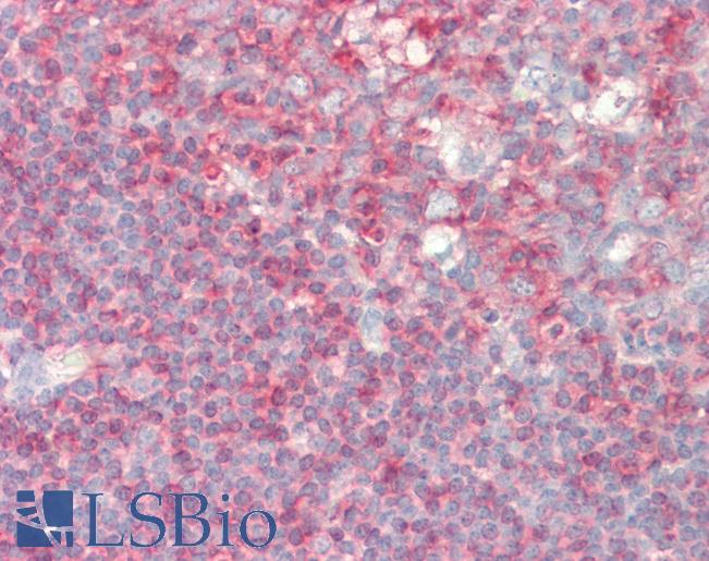 Anti-PIP5K1A antibody IHC staining of human tonsil. Immunohistochemistry of formalin-fixed, paraffin-embedded tissue after heat-induced antigen retrieval. Antibody LS-B10813 concentration 5 ug/ml.