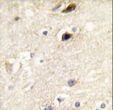 Formalin-fixed and paraffin-embedded human brain tissue reacted with PIP5K1B antibody , which was peroxidase-conjugated to the secondary antibody, followed by DAB staining. This data demonstrates the use of this antibody for immunohistochemistry; clinical relevance has not been evaluated.