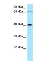 PIP5KL1 antibody LS-C145979 Western blot of 1 Cell lysate. Antibody concentration 1 ug/ml.