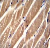 PIP5KL1 Antibody immunohistochemistry of formalin-fixed and paraffin-embedded human skeletal muscle followed by peroxidase-conjugated secondary antibody and DAB staining.