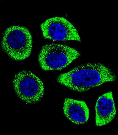 Confocal immunofluorescent of PIP5KL1 Antibody with U-251MG cell followed by Alexa Fluor 488-conjugated goat anti-rabbit lgG (green). DAPI was used to stain the cell nuclear (blue).