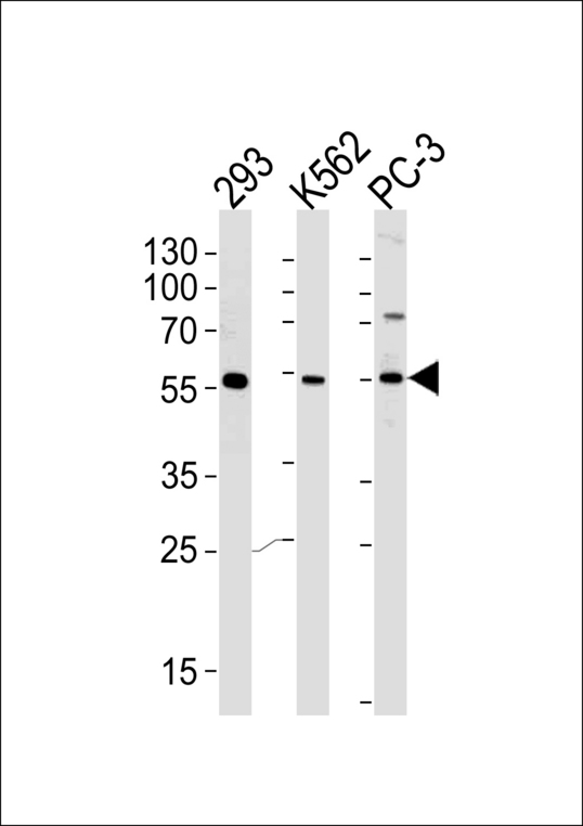 Western blot of lysates from 293,K562,PC-3 cell line (from left to right),using PIP5KL1 Antibody. Antibody was diluted at 1:1000 at each lane. A goat anti-rabbit IgG H&L (HRP) at 1:5000 dilution was used as the secondary antibody.Lysates at 35ug per lane.
