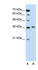PIPOX antibody LS-C40386 Western blot of Jurkat lysate.