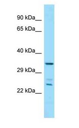 PITPNC1 antibody Western Blot of Mouse Small Intestine.