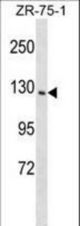 PITPNM1 Antibody western blot of ZR-75-1 cell line lysates (35 ug/lane). The PITPNM1 antibody detected the PITPNM1 protein (arrow).
