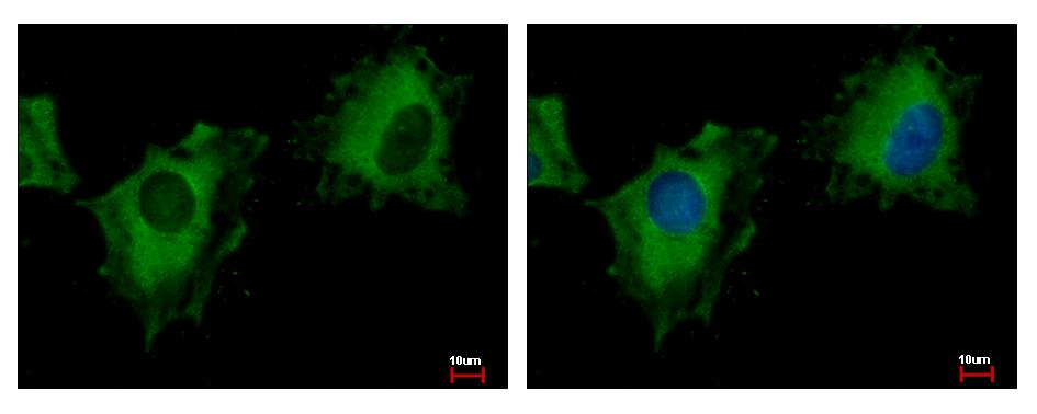 NIR1 antibody [C3], C-term detects PITPNM3 protein at cytoplasm by immunofluorescent analysis. HeLa cells were fixed in -20 100% MeOH for 5 min. PITPNM3 protein stained by NIR1 antibody [C3], C-term diluted at 1:500. 