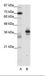 A: Marker, B: Jurkat Cell Lysate