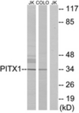 Western blot of extracts from Jurkat/COLO cells, using PITX1 Antibody. The lane on the right is treated with the synthesized peptide.
