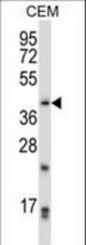 PITX2 Antibody western blot of CEM cell line lysates (35 ug/lane). The PITX2 antibody detected the PITX2 protein (arrow).