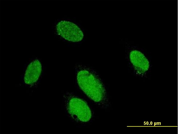 Immunofluorescence of monoclonal antibody to PITX2 on HeLa cell . [antibody concentration 10 ug/ml]