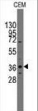 Western blot of anti-Pilx2 antibody in CEM cell line lysates (35 ug/lane). Pilx2(arrow) was detected using the purified antibody.