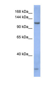 PIWIL1 antibody LS-C110629 Western blot of Fetal Stomach lysate.