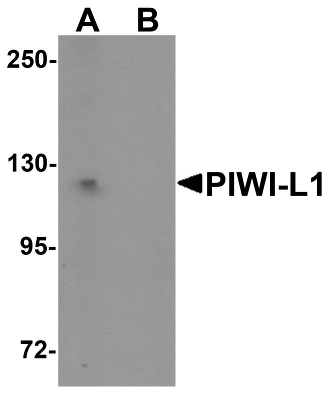 Western blot analysis of PIWI-L1 in HepG2 cell lysate with PIWI-L1 antibody at 1 ug/ml in (A) the absence and (B) the presence of blocking peptide.