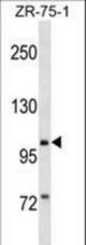PIWIL2 Antibody western blot of ZR-75-1 cell line lysates (35 ug/lane). The PIWIL2 antibody detected the PIWIL2 protein (arrow).
