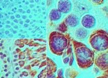 IHC of Mili in formalin-fixed, paraffin-embedded mouse testis tissue using an isotype control (top left) and LS-C148690 (bottom left, right) at 5 ug/ml.