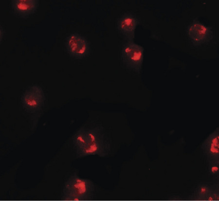 Immunofluorescence of PIWI-L2 in HepG2 cells with PIWI-L2 antibody at 5 ug/ml.