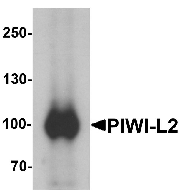 Western blot analysis of PIWI-L2 in HepG2 cell lysate with PIWI-L1 antibody at 1 ug/ml.