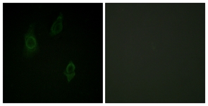 Immunofluorescence of HepG2 cells, using PKC-pan (Phospho-Thr497) Antibody. The sample on the right was incubated with synthetic peptide.