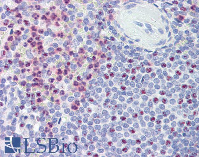 Anti-PKD1 antibody IHC of human spleen. Immunohistochemistry of formalin-fixed, paraffin-embedded tissue after heat-induced antigen retrieval. Antibody LS-B3847 concentration 3.75 ug/ml.
