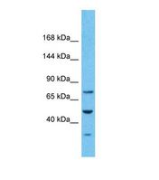 Western blot of Human Stomach Tumor. PKD2 antibody dilution 1.0 ug/ml.