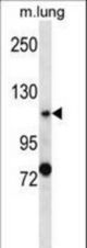PKD2 Antibody western blot of mouse lung tissue lysates (35 ug/lane). The PKD2 antibody detected the PKD2 protein (arrow).