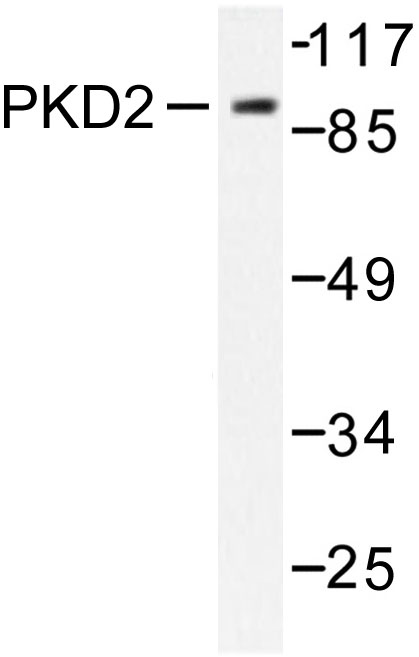 Western blot of PKD2 (A872) pAb in extracts from NIH/3T3 cells treated with PMA 250ng/ml 15'.