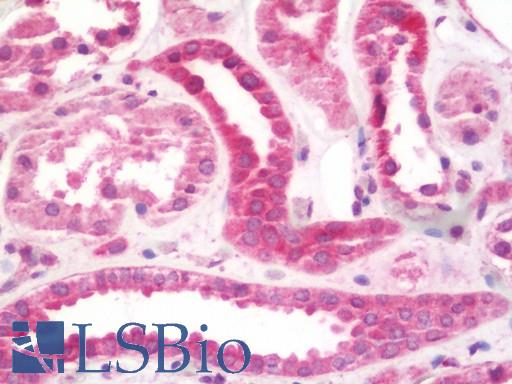 Anti-PKD2 / Polycystin 2 antibody IHC staining of human kidney. Immunohistochemistry of formalin-fixed, paraffin-embedded tissue after heat-induced antigen retrieval.