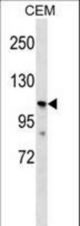 PKD2L1 Antibody western blot of CEM cell line lysates (35 ug/lane). The PKD2L1 antibody detected the PKD2L1 protein (arrow).