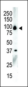 Western blot of anti-PKC nu C-term antibody in NCI-H460 cell lysate. PKC nu (arrow) was detected using purified antibody. Secondary HRP-anti-rabbit was used for signal visualization with chemiluminescence.