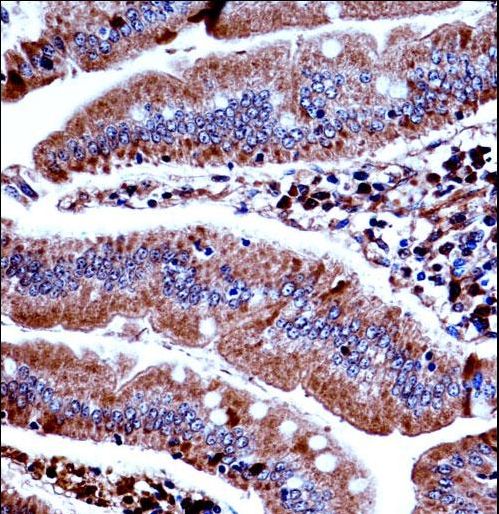 Mouse Prkd3 Antibody immunohistochemistry of formalin-fixed and paraffin-embedded mouse duodenum tissue followed by peroxidase-conjugated secondary antibody and DAB staining.