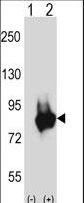 Western blot of Prkd3 (arrow) using rabbit polyclonal Mouse Prkd3 Antibody. 293 cell lysates (2 ug/lane) either nontransfected (Lane 1) or transiently transfected (Lane 2) with the Prkd3 gene.