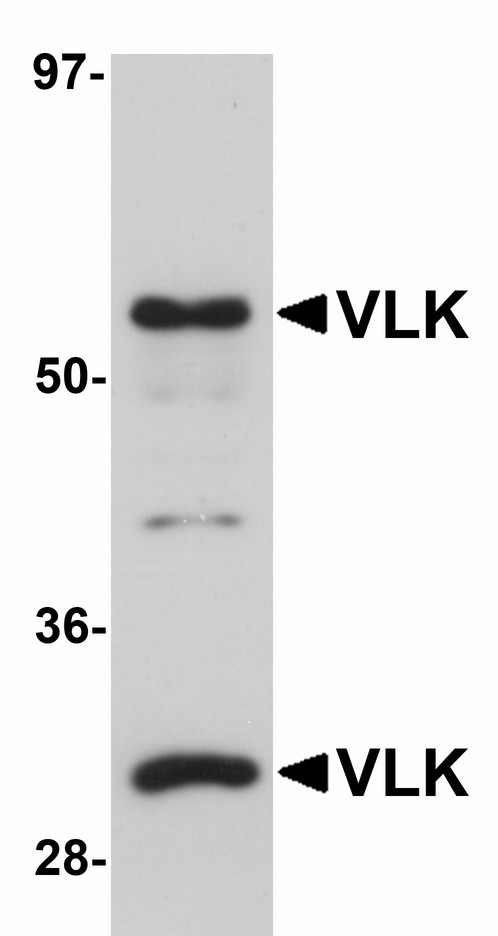 Western blot of VLK in human lung tissue lysate with VLK antibody at 1 ug/ml.