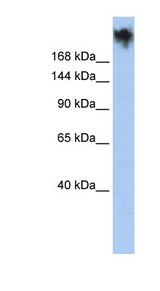 PKDREJ antibody LS-C101534 Western blot of HepG2 cell lysate.