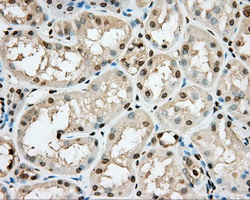 IHC of paraffin-embedded Kidney tissue using anti-PRKG1 mouse monoclonal antibody. (Dilution 1:50).