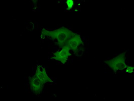 Anti-PRKG1 mouse monoclonal antibody immunofluorescent staining of COS7 cells transiently transfected by pCMV6-ENTRY PRKG1.