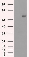 HEK293T cells were transfected with the pCMV6-ENTRY control (Left lane) or pCMV6-ENTRY PRKG1 (Right lane) cDNA for 48 hrs and lysed. Equivalent amounts of cell lysates (5 ug per lane) were separated by SDS-PAGE and immunoblotted with anti-PRKG1.