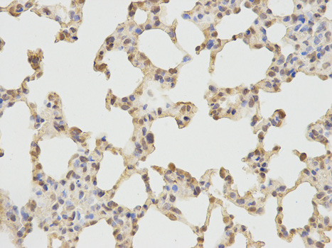Immunohistochemistry of paraffin-embedded rat lung using PRKG1 antibody at dilution of 1:100 (400x lens).