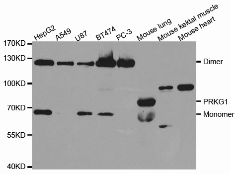 Western blot analysis of extracts of various cell lines, using PRKG1 antibody.