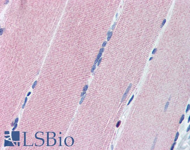 Anti-PRKG1 / CGKI antibody IHC of human skeletal muscle. Immunohistochemistry of formalin-fixed, paraffin-embedded tissue after heat-induced antigen retrieval. Antibody LS-B2219 concentration 10 ug/ml.